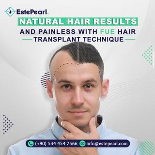 A fresh start, a new confidence 💫
Hair transplant journey in Turkey — professional care, advanced t