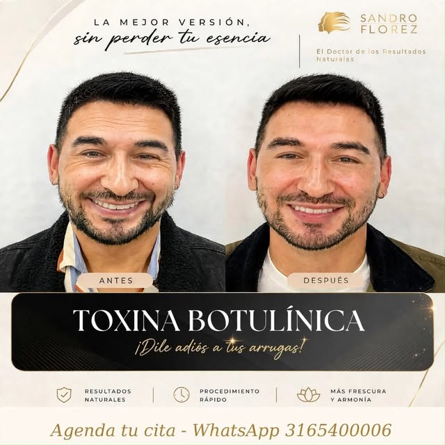 Nuestros pacientes son testigos de los resultados del Bótox 😃 ¡Sin perder tu expresión natural! Age