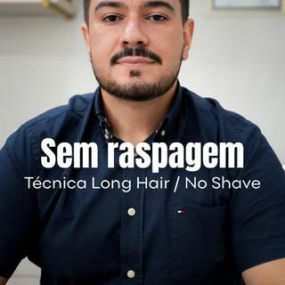 ✨ Transplante capilar sem raspar o cabelo já é realidade.

✔️mais discrição 
✔️recuperação mais rápi