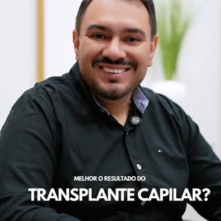 Um bom transplante capilar começa com planejamento, distribuição adequada e a angulação correta dos 