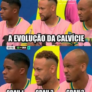 Entre um meme e outro, fica um lembrete importante: 
A CALVÍCIE EVOLUI. 

O tratamento precoce faz t