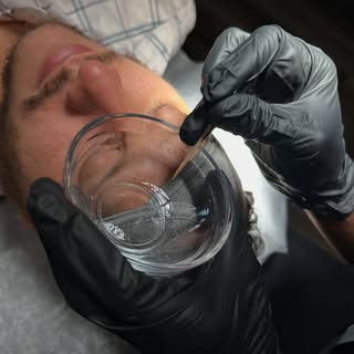 Thinking about a #chemicalpeel but not sure if it’s worth it?

Here are 3 reasons patients in #Dulut