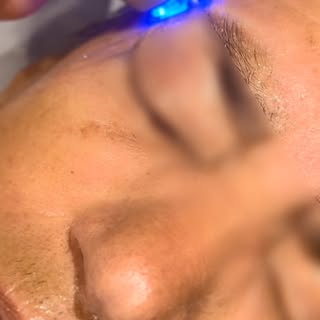 La radiofréquence visage : le soin qui stimule votre peau naturellement

Envie d’une peau plus ferme