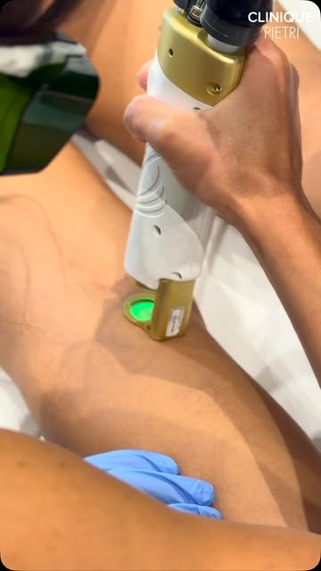 ⚠️ Petit rappel important avant une séance d’épilation laser ⚠️

L’épilation laser ne doit jamais êt