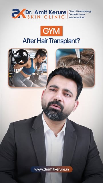 Does sweating actually ruin your newly transplanted hair grafts? 

While sweat itself isn't the enem