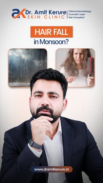 Does the Mumbai monsoon really cause hair fall?

Yes! High humidity and sweat make your scalp oily, 