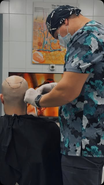 Первые этапы перед пересадкой волос.

Немного нашего рабочего процесса