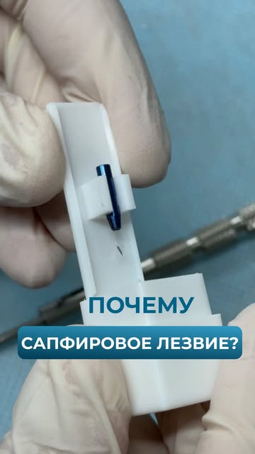 Сапфировое лезвие используется для создания каналов, куда затем будут пересажены графты. Почему имен