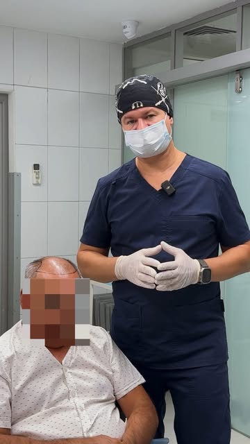 Пациент с 6-й степенью облысения.

Три года назад он сделал трихопигментацию — имитацию волосяных фо