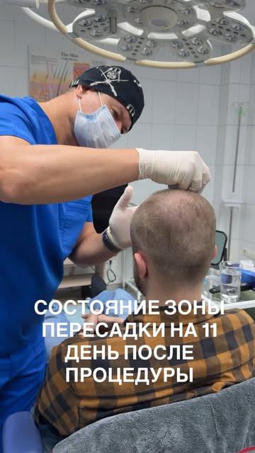 На видео — немного процесса и состояние зоны пересадки на 11-й день после процедуры.

Это только нач