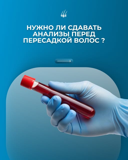 Анализы перед пересадкой волос обязательны. Их можно сдать в любой лаборатории по месту жительства, 