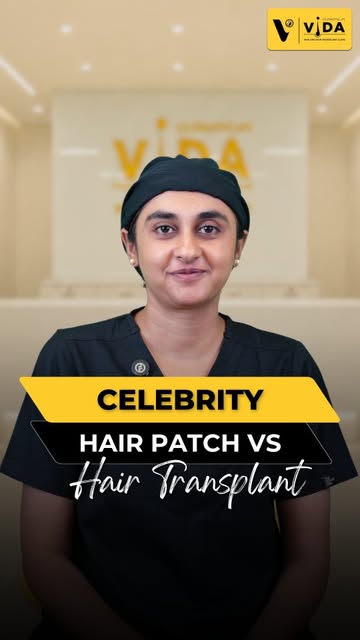 **Celebrity Hair Patch vs Hair Transplant — which one would you choose?**

Hair patches can give an 