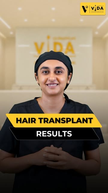 **Hair Transplant Results: What Can You Really Expect?**

A hair transplant is a gradual process, no