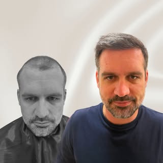Neste caso, o objetivo não era simplesmente preencher as áreas com menor densidade, mas reconstruir 