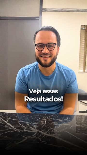Quem melhor para falar sobre um transplante capilar do que quem já passou por todo o processo?

Para