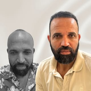 Um resultado que mostra como densidade e naturalidade precisam caminhar juntas.

Neste caso, havia u
