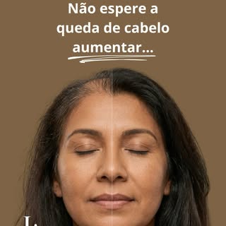 Não espere o cabelo ficar visivelmente mais ralo para procurar ajuda.

É comum perceber alguns fios 