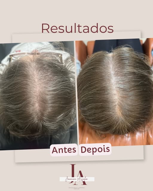 Amo ver cabelos novos 😍
A terapia capilar é muito mais que cabelo, é transformar a autoestima