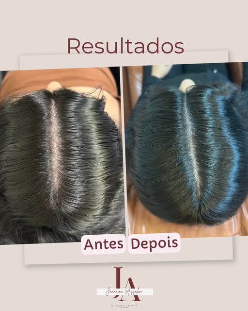 Paciente me procurou para cuidar de uma queda de cabelo relacionado a problemas de tireoide, indique