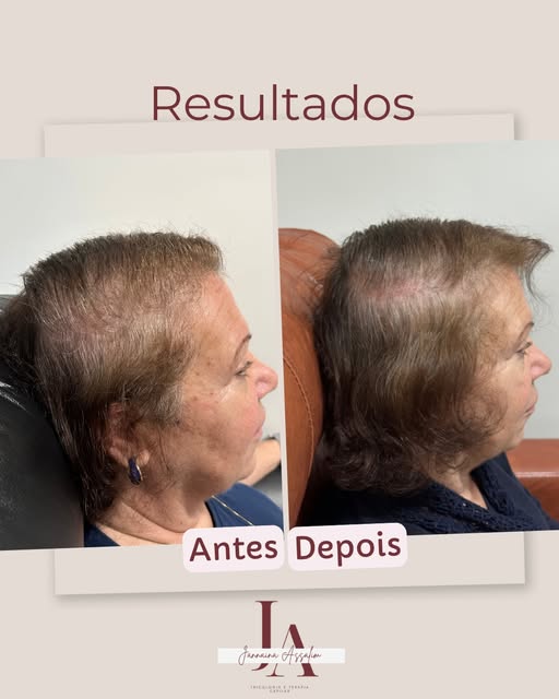 Recuperação capilar 😍❤️