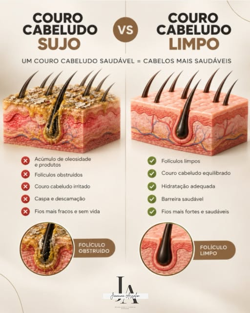 Seu couro cabeludo pode estar mais sujo do que você imagina. 👀

Oleosidade, resíduos de produtos, c