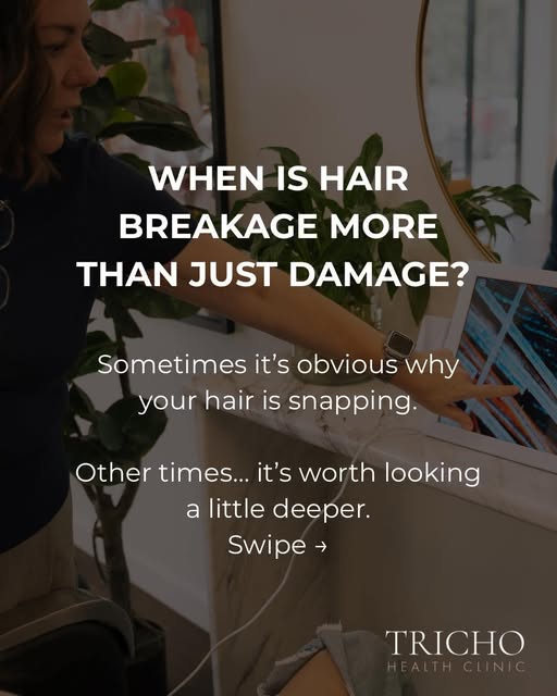 “My hair keeps breaking… but I’ve stopped bleaching and using so much heat. Why is it STILL happenin