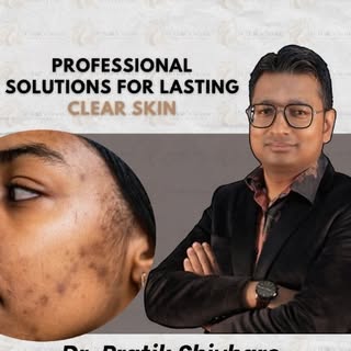 Say Goodbye to Acne – For Good
If acne, scars, or recurring breakouts are affecting your confidence,