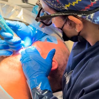 ✨ Did you know? ✨
When the traditional donor area (the back of the scalp) isn’t an option, beard hai