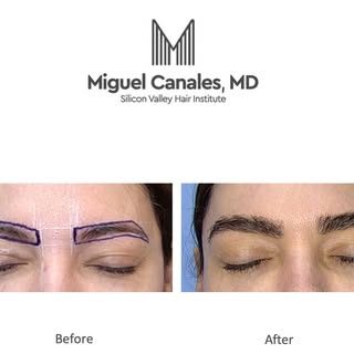 The eyebrow is the quiet architecture of the face-it frames the eyes, shapes expression,
and gives b
