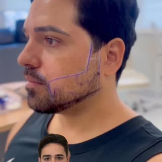 Um resultado que vai além da barba.
É sobre confiança, autopercepção e a forma como a pessoa se apre