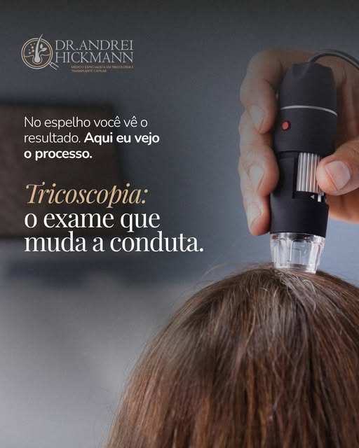 No espelho, você enxerga o resultado. Na tricoscopia, eu enxergo o processo.

O exame amplia o couro