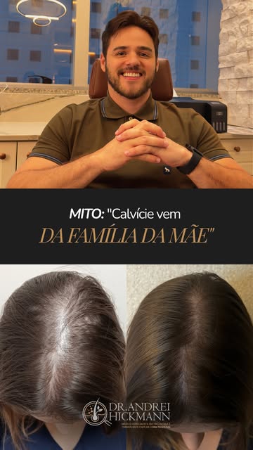 A calvície não vem só do pai, é poligenética e pode vir também da mãe. 👩‍🦱👨‍🦲

Homens e mulheres