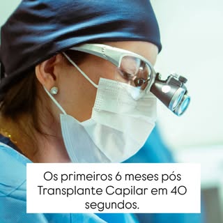 🧔🏻‍♂️ O sucesso do seu transplante capilar começa com o entendimento do cronograma de evolução.
Nã