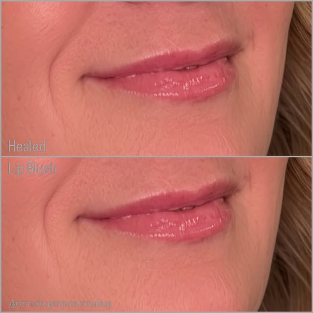 👄Her lips look like this without a single swipe of lipstick.

Lip blush enhancement using our 9-Ste