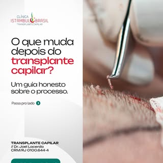Uma das perguntas que mais recebo: “Como é o
processo depois da cirurgia?”

A resposta honesta: é gr