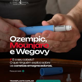Você usa Ozempic, Mounjaro ou Wegovy e notou que seu cabelo está caindo mais?

Isso tem explicação c