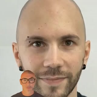 ✨ Giovane età. Effetto rasato. Risultato naturale. 💈

La tricopigmentazione non deve attirare l’att