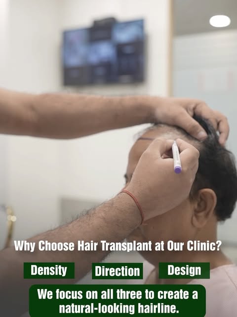 If you’re noticing thinning, a receding hairline, or bald patches, you don’t have to simply “live wi