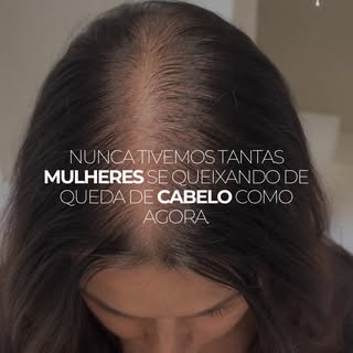 Vivemos uma geração de mulheres perdendo cabelo e precisamos falar sobre isso.

Arraste para o lado 
