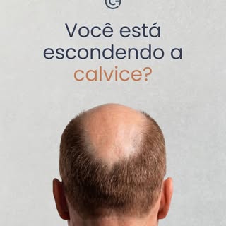 Você usa isso pra esconder a calvície? 👀

Fibra capilar, pó, maquiagem de couro cabeludo… parece um