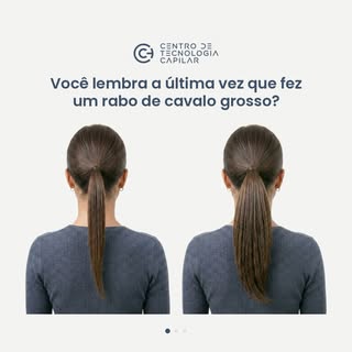 ⏳ Comente “CABELO” e receba um quiz gratuito na sua DM para saber se sua queda é normal ou excessiva