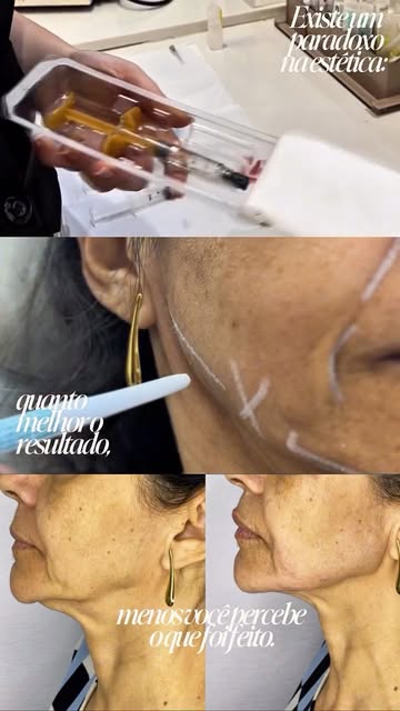 O objetivo da boa estética nunca foi mudar quem você é. É sobre ajustes finos. Cuidar dos detalhes c