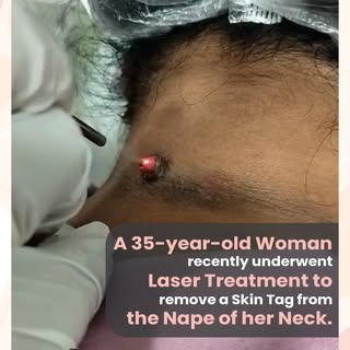 Discover the artistry of Dr. Srilekha as she empowers a 35-year-old woman to reclaim her confidence 