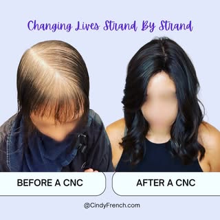 Changing Lives Strand by Strand ✨

At Cindy French Hair Solutions, we're not just restoring hair; we