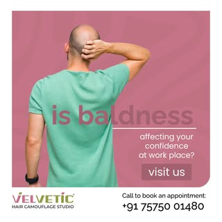 Is baldness affecting your confidence at work? 💼 We’ve got the solution to help you feel like your 