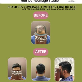 From thinning to winning!
Check out this amazing before-and-after transformation with our hair camou