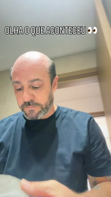 @sadirventurinjr | Prótese capilar mudou muito mais do que a estética pra mim.

Fiz a minha com o @r