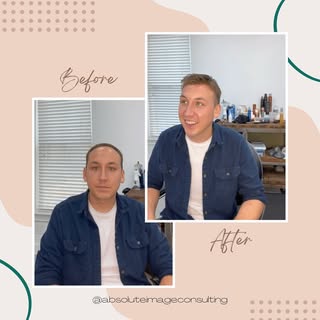 We love a good before and after! Check out this fabulous #nonsurgicalhairreplacement transformation.