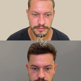 Restauração capilar é saúde, é cuidado, é transformação.
Recuperar o cabelo não é apenas uma questão