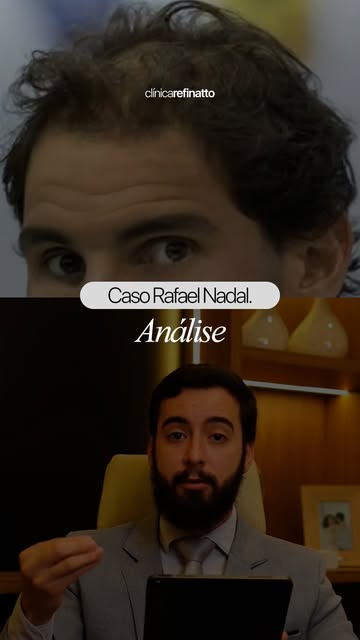 Análise de hoje: Rafael Nadal!

Hoje o Dr. Murilo vai contar para vocês o que pode ter acontecido e 